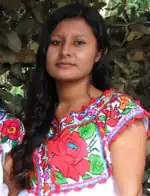 Amerindian with black hair from North America with the ancestral A-allele