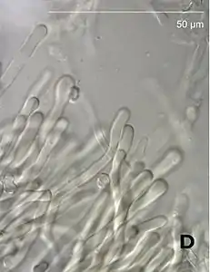 Cystidia-like structures
