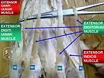 Extensor digitorum muscle