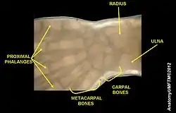 Micro-radiography of 8 weeks human embryo hand