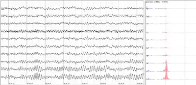 Human EEG with prominent resting state activity – alpha-rhythm. Left: EEG traces (horizontal – time in seconds; vertical – amplitudes, scale 100&nbsp;μV). Right: power spectra of shown signals (vertical lines – 10 and 20&nbsp;Hz, scale is linear). Alpha-rhythm consists of sinusoidal-like waves with frequencies in 8–12&nbsp;Hz range (11&nbsp;Hz in this case) more prominent in posterior sites. Alpha range is red at power spectrum graph.