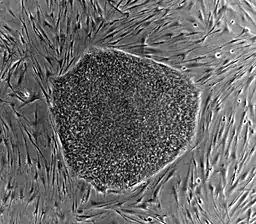 Human embryonic stem cell colony on mouse embryonic fibroblast feeder layer