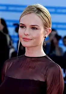 Actress Kate Bosworth has complete heterochromia: her left eye is blue and her right eye is hazel.