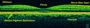 Time-Domain OCT of the macular area of a retina at 800&nbsp;nm, axial resolution 3&nbsp;µm