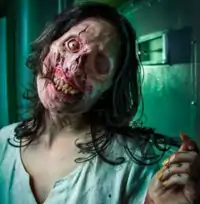 Disfigured woman in mental hospital