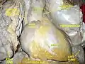 Ascending aorta