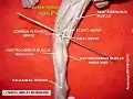 Biceps femoris
