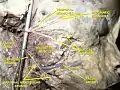Facial artery.Deep dissection.Lateral view.