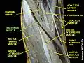 Sartorius muscle
