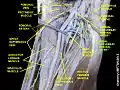 Medial circumflex femoral artery