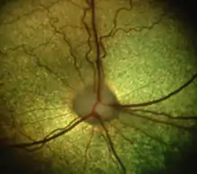 Image 6Dog retina showing optic disc and vasculature [epiCam] (from Dog anatomy)