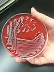 Staphylococcus aureus: large opaque, round, creamy, white to yellowish colonies displaying beta-hemolysis on blood agar: 167–73 
