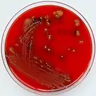 Streptococcus pyogenes: small translucent colonies displaying beta-hemolysis on blood agar: 167 : 216 
