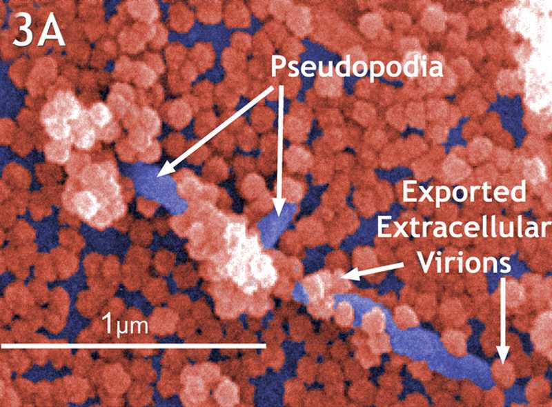 This colorized scanning electron micrograph (SEM) reveals the “rosettelike” appearance of the matured SARS-CoV (coronavirus) particles (arrows).