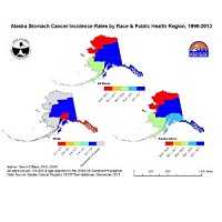 Stomach Cancer Incidence Rates by Race and Public Health Region, AK