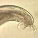 Angiostrongylus sp. male worm.