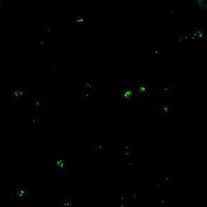 Positive IFA result with B. microti antigen.