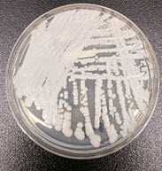A strain of C. auris cultured in a petri dish A strain of C. auris cultured in a petri dish