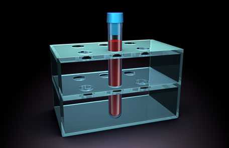 Preventing Inhibitors