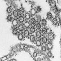 Image of a flu virus.