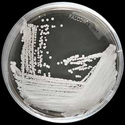 A strain of candida auris cultured ina petri dish at CDC.
