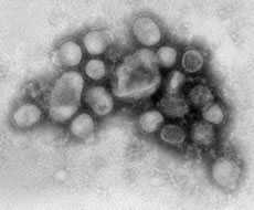 Image of H1N1 influenza virus