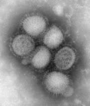Image of H1N1 influenza virus