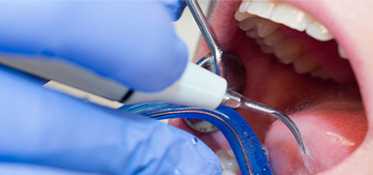 	Dentist operating on a patients mouth