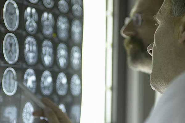 Two male doctors looking at X-Rays and MRI scans, pointing at scan