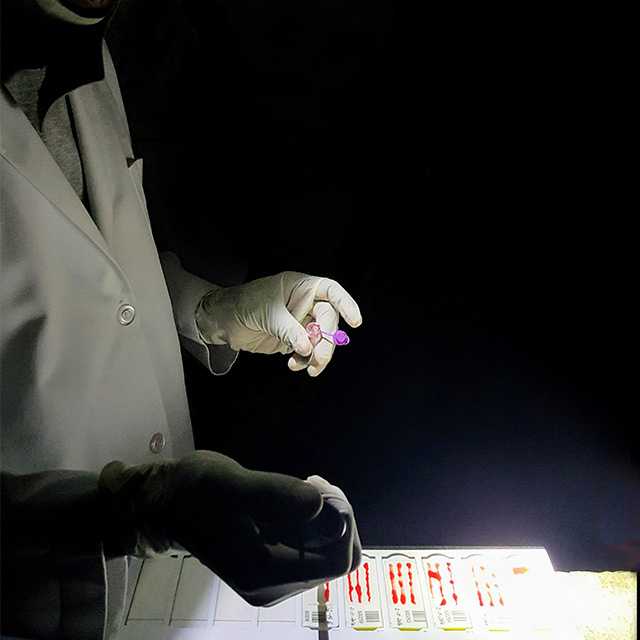 A laboratorian prepares blood slides