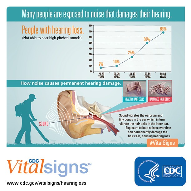 Infographic: Many people are exposed to noise that damages their hearing.