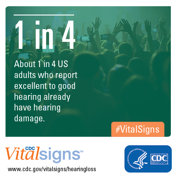 About 1 in 4 US adults who report excellent to good hearing already have hearing damage.