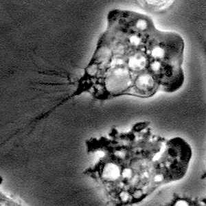 Photo: Naegleria fowleri