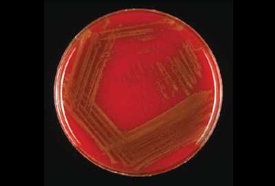 Figure 7 is a picture showing proper streaking and growth of S. pneumoniae on a blood agar plate (BAP).