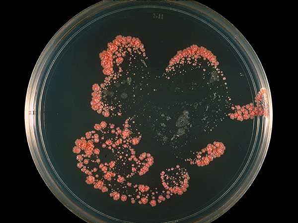 image of culture of bacteria N. asteroides, which causes at least half of invasive infections of nocardiosis