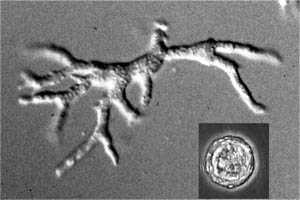 	Photo: Balamuthia mandrillaris trophozoite and cyst