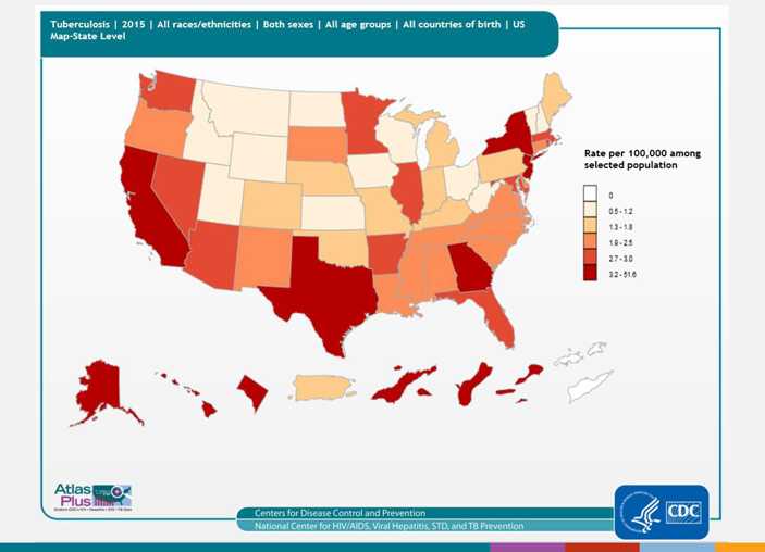 Query and graphics are based on TB surveillance data. Data may include a combination of the following: TB diagnoses; by state, year, race/ethnicity, sex, and age group; shown in numbers and rates