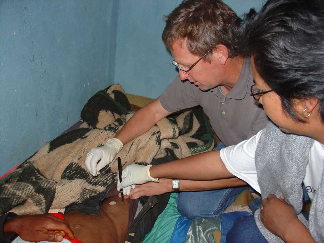 Doctors examining a bubo caused by plague.