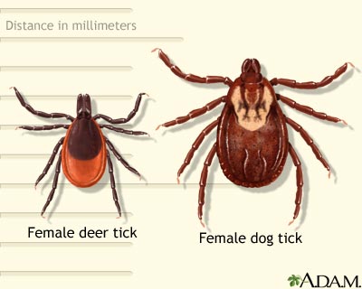 Deer and dog tick