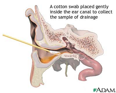 Ear drainage culture