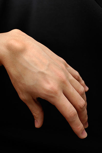 File:Ganglion-cyst.jpg