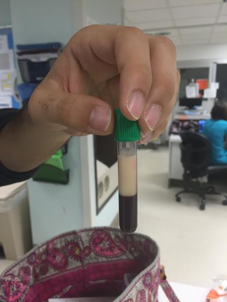 File:Hypertriglyceridemia green top.jpg