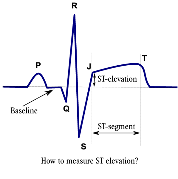 File:597px-Stelevatie en.png