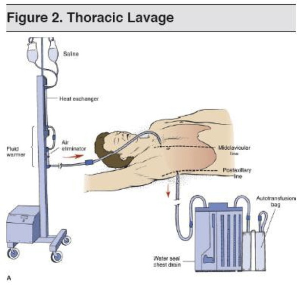 File:Thoraciclavage.png