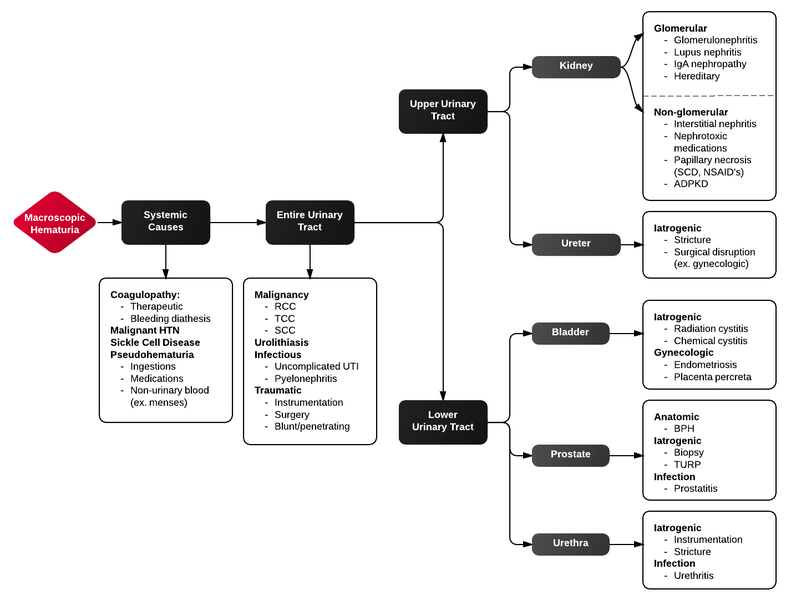 File:Macroscopic hematuria.png