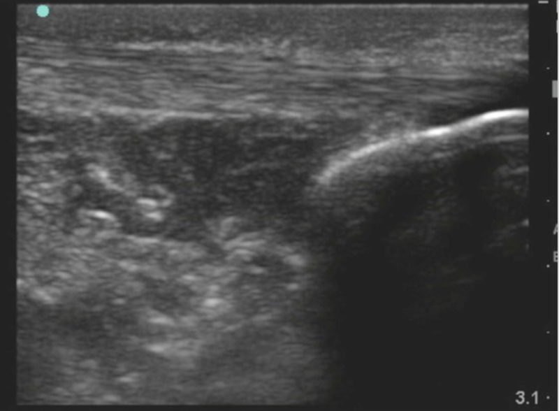 File:Intact tendon.png