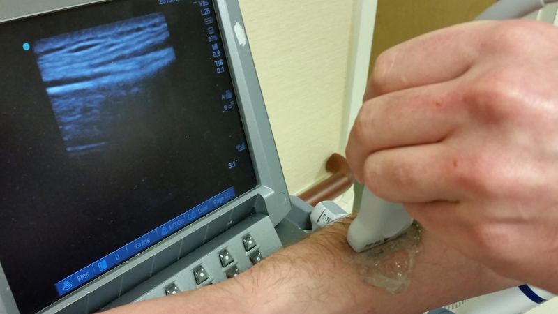 File:Longitudinal Bone Probe.jpg