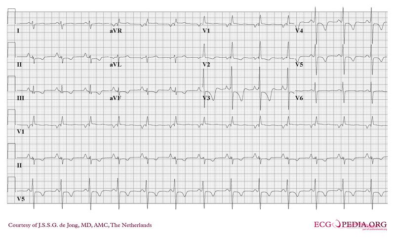 File:RVH 12-lead.jpg