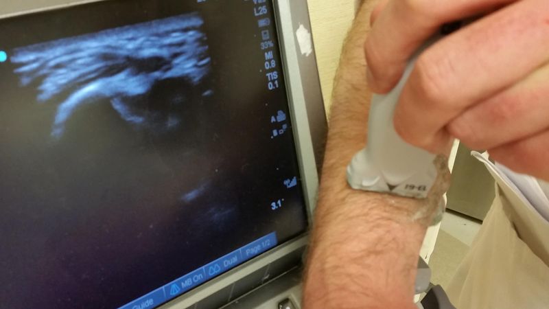 File:Short Bone Probe.jpg