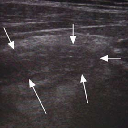 File:Appy long axis.png